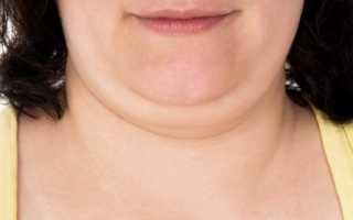 Как убрать второй подбородок: все возможные способы