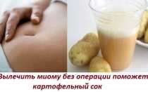Как вылечить миому матки с помощью картофельного сока