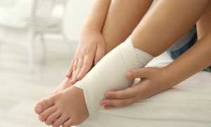 Почему опухают ноги в районе стопы у женщин, лечение отеков