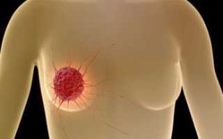 Анжелик: состав, показания, дозировка, побочные эффекты