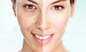 Здоровый образ жизни или правильная косметика — что больше всего способствует улучшению цвета лица?