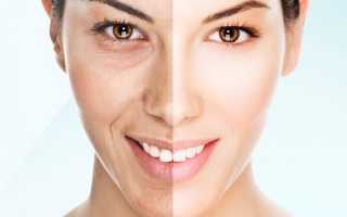 Здоровый образ жизни или правильная косметика — что больше всего способствует улучшению цвета лица?