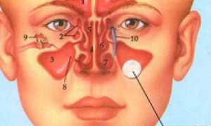 Киста верхнечелюстной пазухи: причины и лечение, симптомы, размеры для удаления